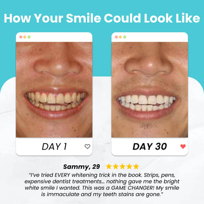 FastSmile™ Zahnbürste